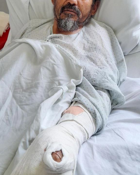 Mohammad, vittima di mina